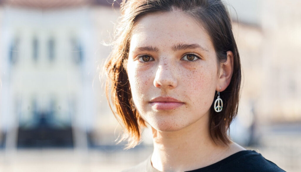 teen-girl-freckles-min